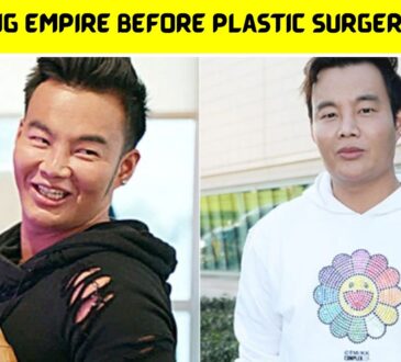 Kane Bling Empire Before Plastic Surgery Photos