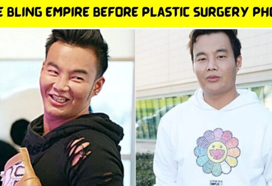 Kane Bling Empire Before Plastic Surgery Photos