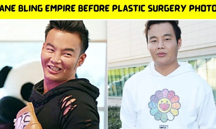 Kane Bling Empire Before Plastic Surgery Photos