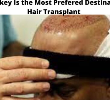 Why Turkey Is the Most Prefered Destination for Hair Transplant