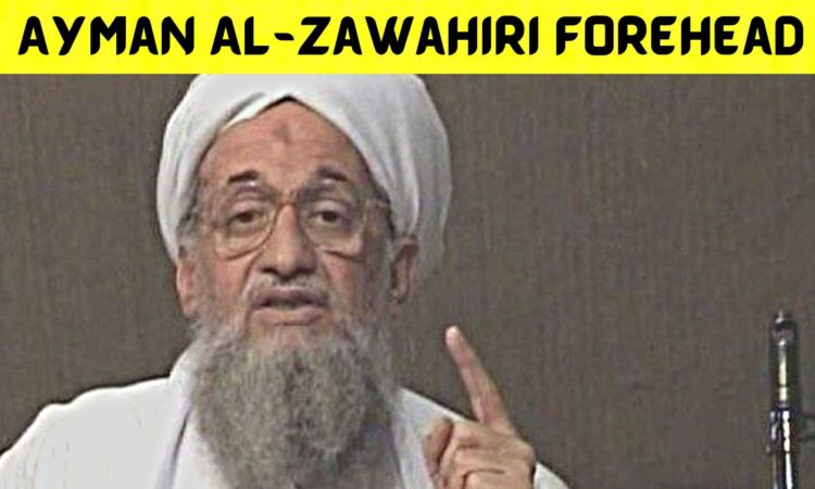 Ayman Al-zawahiri Forehead