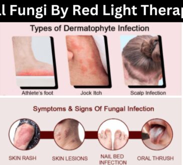 Kill Fungi By Red Light Therapy