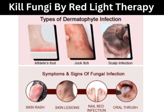 Kill Fungi By Red Light Therapy